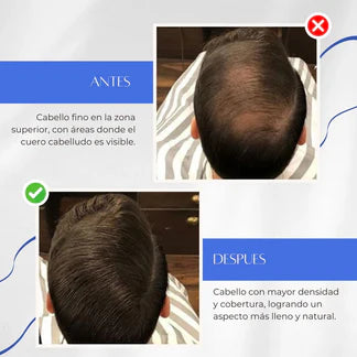 Toppik™ – Fibra Capilar 3 en 1: Instantáneo, Natural y Duradero