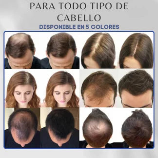 Toppik™ – Fibra Capilar 3 en 1: Instantáneo, Natural y Duradero